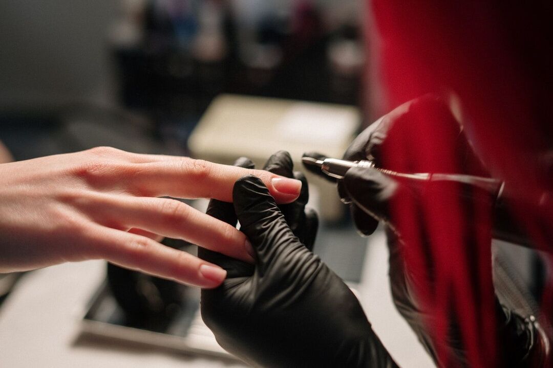 causas de hongos en las uñas