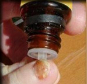 Aplicar gotas en una uña del pie afectada por hongos