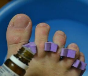 Preparándose para tratar las uñas con gotas antifúngicas.