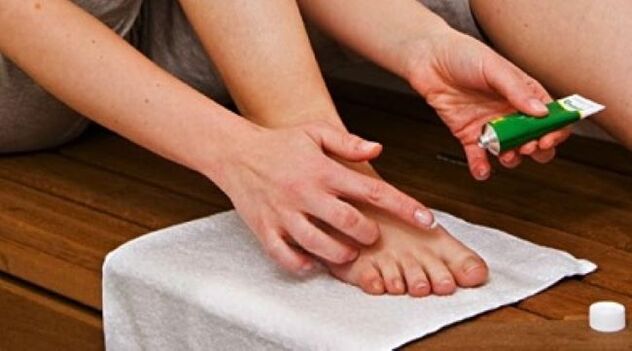 tratamiento de hongos en las uñas de los pies con ungüento